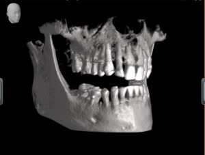 radiografica 3d dentale